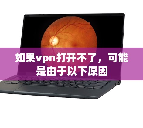 如果vpn打开不了,可能是由于以下原因 如果vpn打开不了,可能是由于以下原因